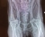 charleys-x-rays-thumbnail